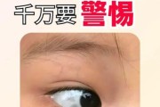 宝宝眼睛有黑点怎么办_宝宝眼睛黑点会消失吗