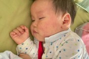 宝宝出幼儿急疹难受吗_幼儿急疹症状会持续多久