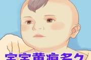 宝宝肝不好有什么症状_新生儿肝功能异常表现