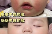 宝宝两个脸蛋发红怎么回事_婴儿脸红发热的原因