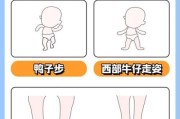 宝宝2岁还不会走路_正常吗