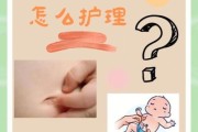 宝宝抠肚脐眼怎么办_宝宝抠肚脐眼会不会感染