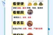 宝宝消化不良有哪些症状_如何判断宝宝消化不良