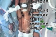 32周早产儿多久能出院_32周早产儿要住保温箱吗