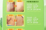 宝宝杨棉过敏症状_怎么快速缓解