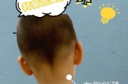 宝宝左斜颈正确睡姿图_怎么睡才安全