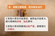 梦到伤口裂开_梦见伤口裂开是什么意思