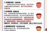宝宝舌苔厚白怎么回事_怎么处理
