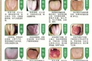 舌头各种症状图片大全_舌象异常对照表