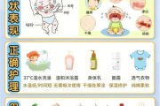宝宝一脸湿疹怎么办_婴儿湿疹怎么护理