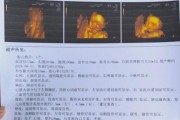 四维宝宝一直趴着不动怎么办_四维检查宝宝不配合怎么调整姿势