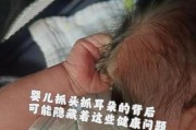 宝宝老抓头是怎么回事_宝宝抓头会秃吗