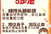 宝宝流鼻血怎么办_最简单止血方法