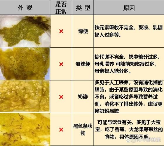 宝宝大便有黏液是怎么回事_宝宝大便颜色对照表