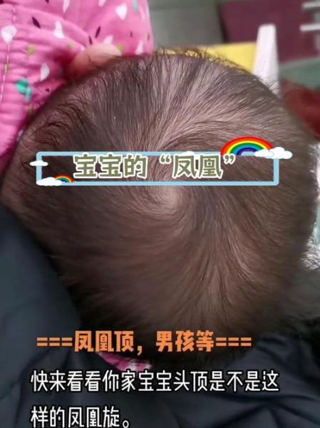 宝宝凤凰头有什么说法_新生儿头型像凤凰怎么办