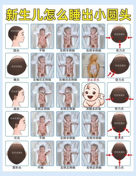 宝宝凤凰头有什么说法_新生儿头型像凤凰怎么办
