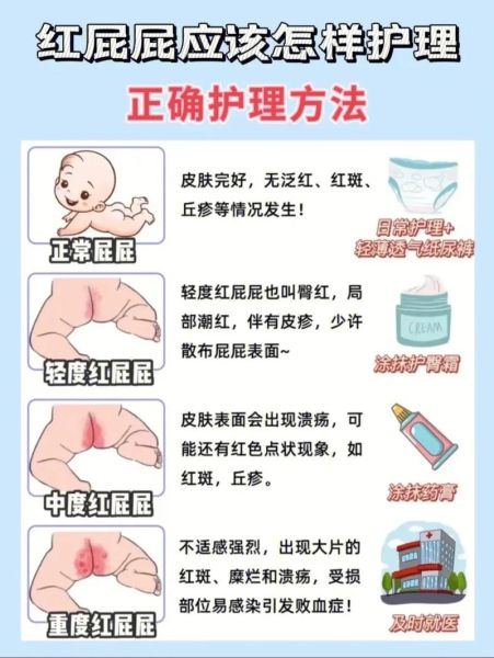一岁宝宝屁眼红怎么办_红屁股护理方法