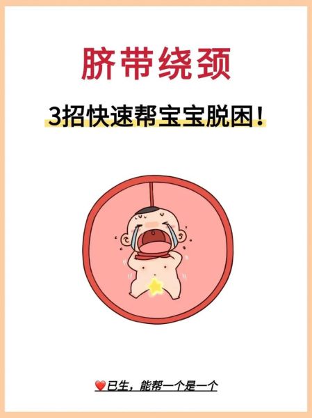 宝宝脐带绕颈怎么办_脐带绕颈一周能顺产吗