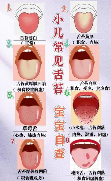 宝宝舌头黄苔怎么回事_如何处理