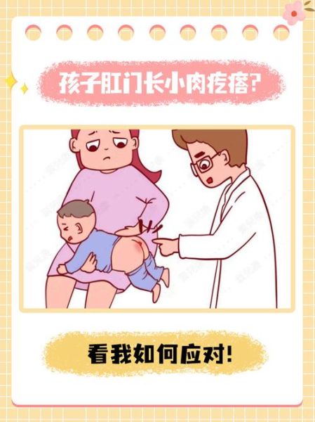 宝宝肛门小疙瘩是什么_宝宝肛门小疙瘩怎么办