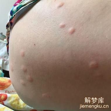 梦到虫子咬我_是什么意思