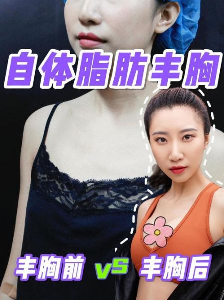 丰胸图片大全_真实效果对比图可信吗