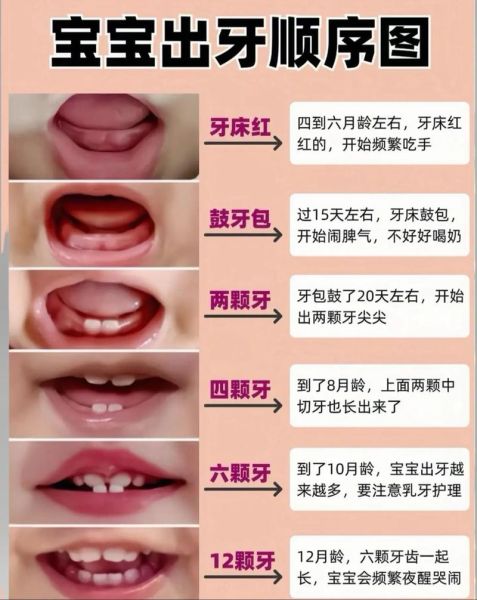 宝宝四个月长牙正常吗_婴儿长牙早的原因