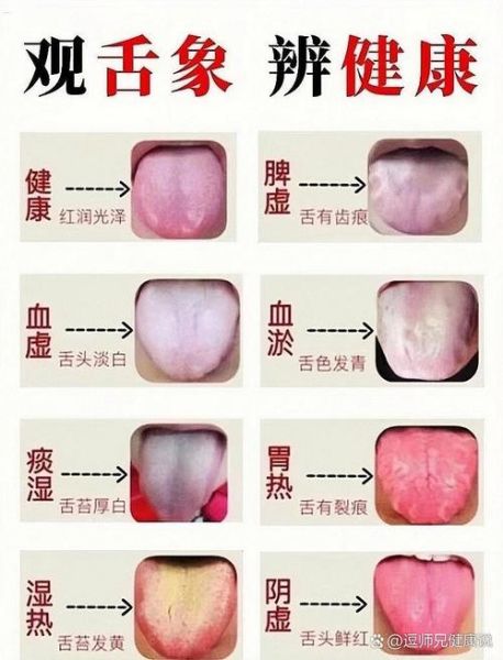 舌头图片大全_正常舌苔颜色对照