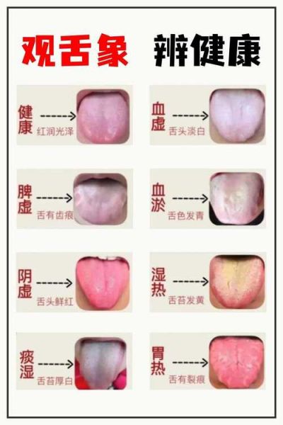 舌头图片大全_正常舌苔颜色对照