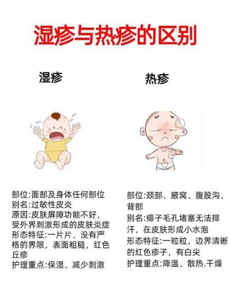 3岁宝宝湿疹反复怎么办_日常护理全攻略