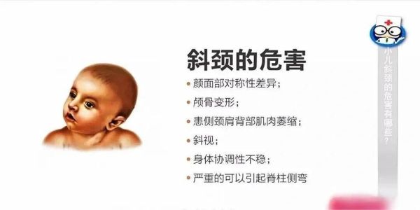 宝宝歪头看东西正常吗_婴儿斜颈如何早期发现