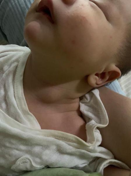 宝宝歪头看东西正常吗_婴儿斜颈如何早期发现