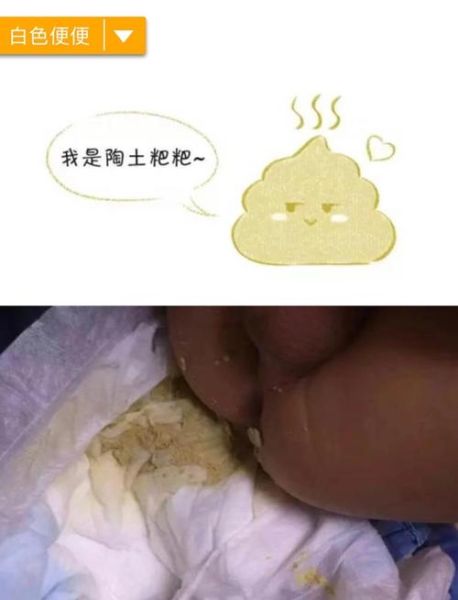 宝宝蛋花样大便怎么回事_需要就医吗