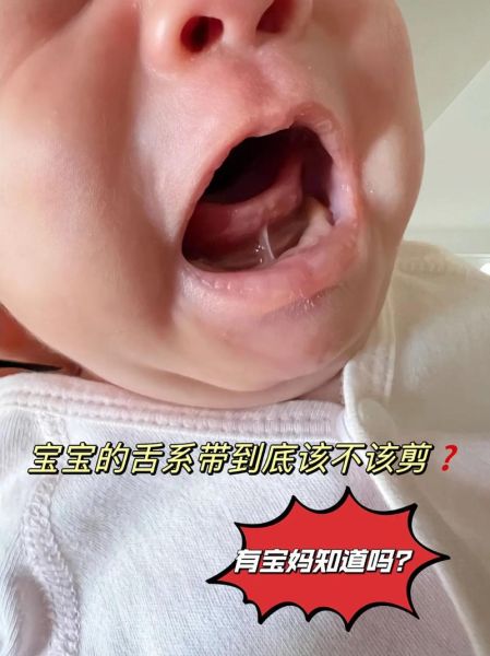 三个月宝宝爱吐舌头正常吗_宝宝吐舌头怎么办