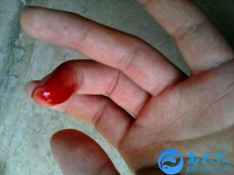 梦到手被刀划破_梦见手受伤流血什么意思