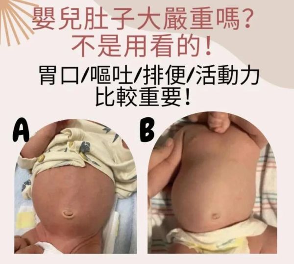 9个月宝宝肚子大正常吗_宝宝肚子鼓鼓的怎么办