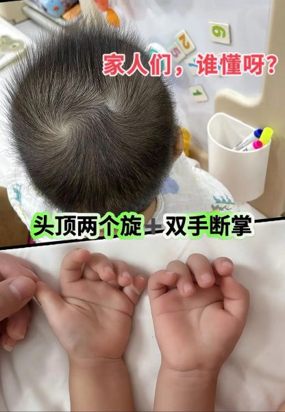 两个旋的宝宝性格特点_两个旋的宝宝聪明吗