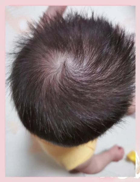 两个旋的宝宝性格特点_两个旋的宝宝聪明吗