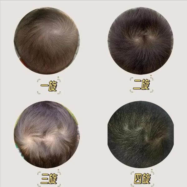 两个旋的宝宝性格特点_两个旋的宝宝聪明吗