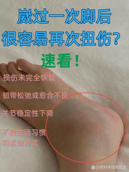 梦到崴脚是什么意思_梦到崴脚预示什么