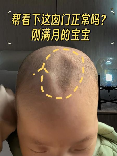 五个月宝宝囟门凹陷怎么回事_怎么判断脱水还是正常
