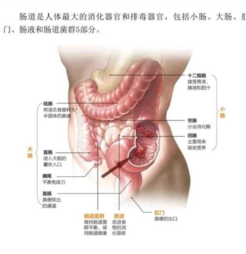 肠子图片大全_正常与病变对比图解