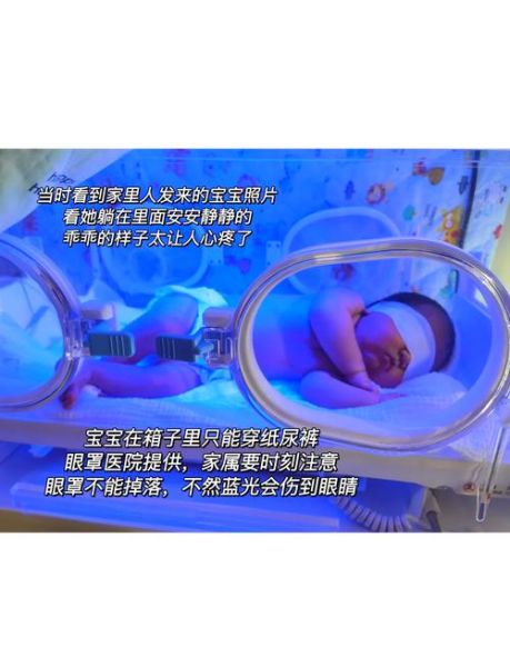 宝宝黄疸20怎么办_黄疸值20需要照蓝光吗