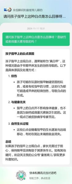 宝宝手指甲上有白点是怎么回事_指甲白点缺什么