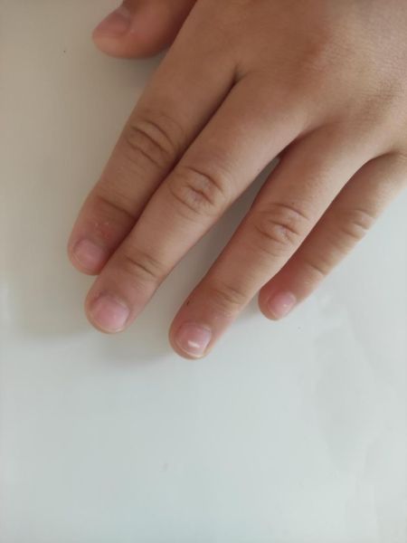 宝宝手指甲上有白点是怎么回事_指甲白点缺什么