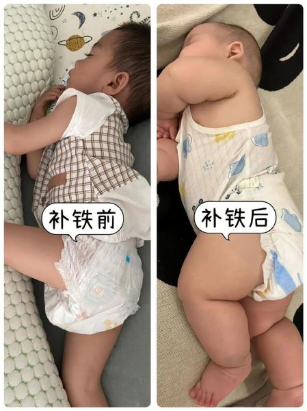 宝宝缺铁会便秘吗_婴儿补铁便秘怎么办