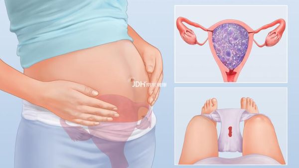 葡萄胎能生下宝宝吗_葡萄胎宝宝图片真实吗