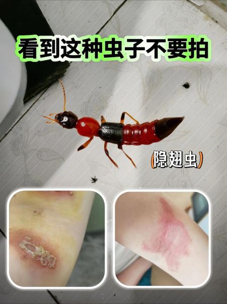 有毒的虫子图片大全_哪些虫子最致命