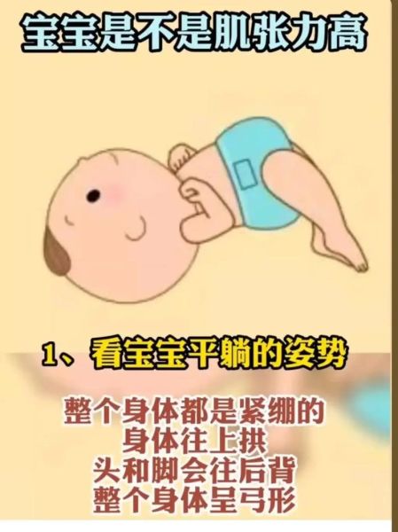 宝宝肌张力高有什么影响_会不会影响走路