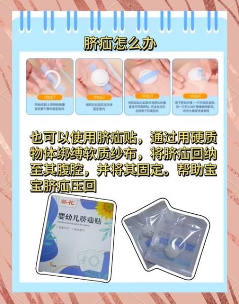 宝宝脐疝会痛吗_脐疝疼痛症状